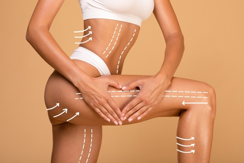 Body Contouring in Buffalo, NY | Explore Non-Surgical Solutions