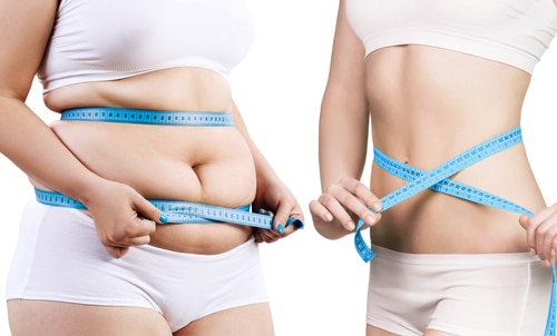 Weight Management Program in Buffalo, NY